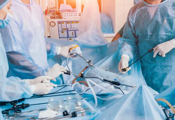 Laparoscopic Gynaecological Surgeries